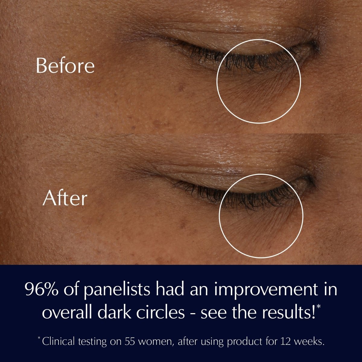 Advanced Night Repair Eye Supercharged Gel - Creme Synchronized Multi - Recovery Eye Cream - RUTHERFORD & Co