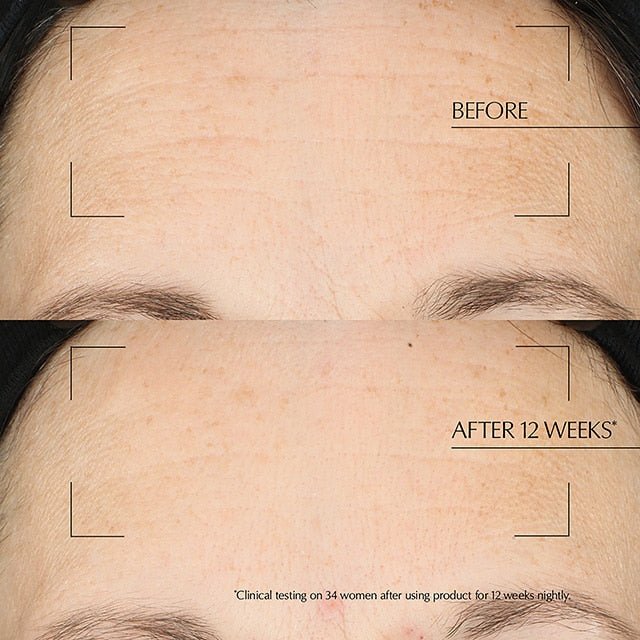 Advanced Night Repair Overnight Treatment - RUTHERFORD & Co