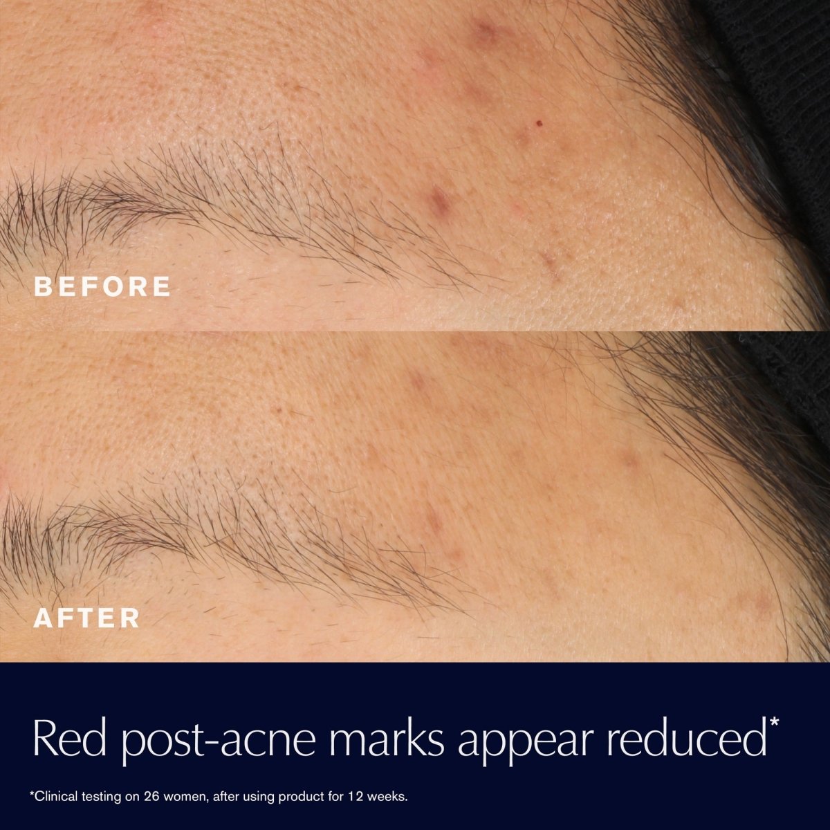 Advanced Night Repair Rescue Solution Serum with 15% Bifidus Ferment - RUTHERFORD & Co