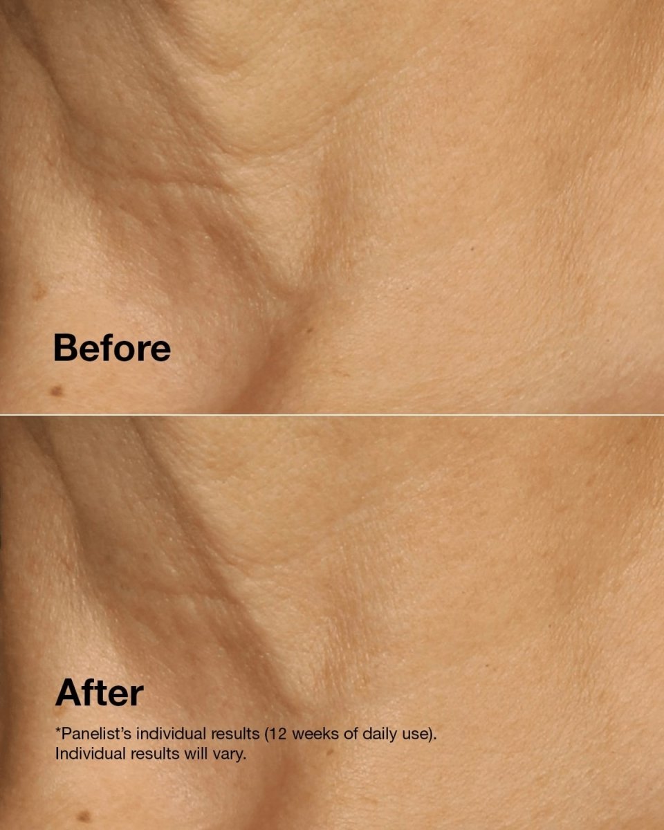 Clinique Smart Clinical Repair™ Lifting Face + Neck Cream - RUTHERFORD & Co