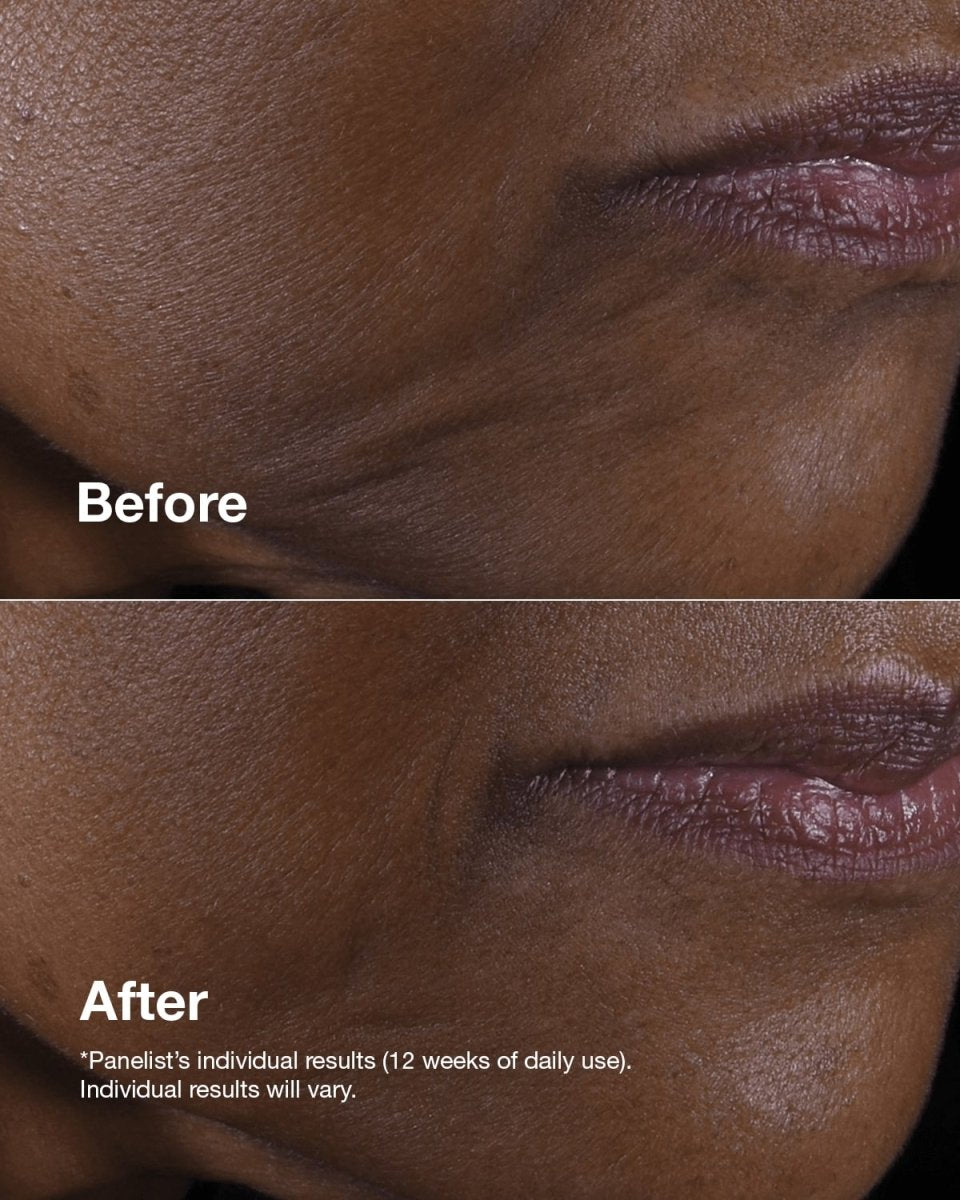 Clinique Smart Clinical Repair™ Lifting Face + Neck Cream - RUTHERFORD & Co