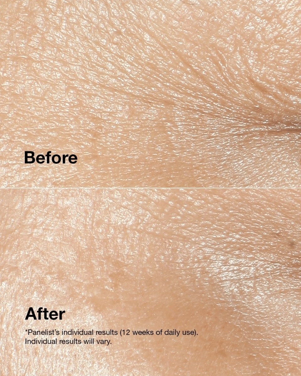 Clinique Smart Clinical Repair™ Wrinkle Correcting Cream - RUTHERFORD & Co