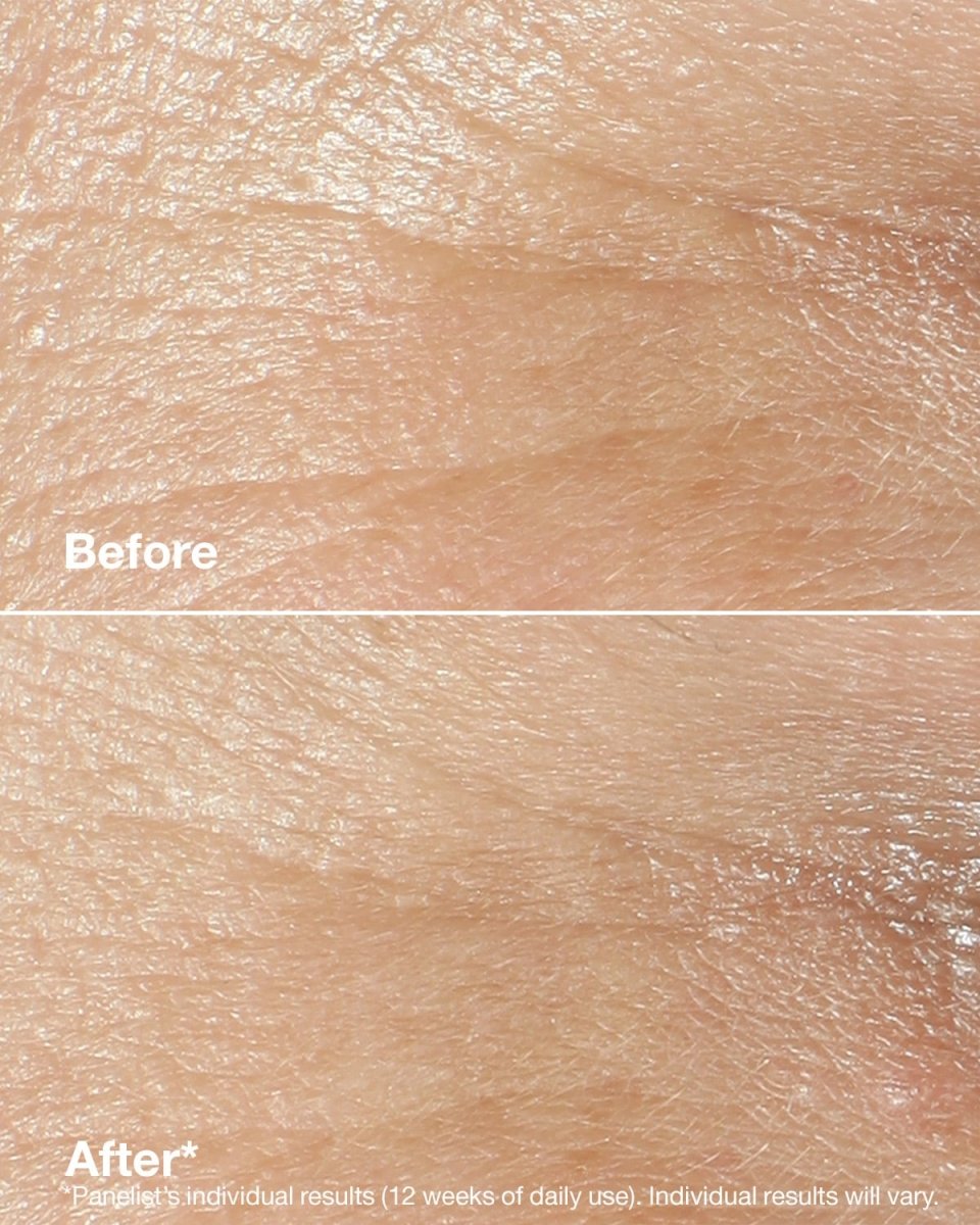 Clinique Smart Clinical Repair™ Wrinkle Correcting Rich Cream - RUTHERFORD & Co