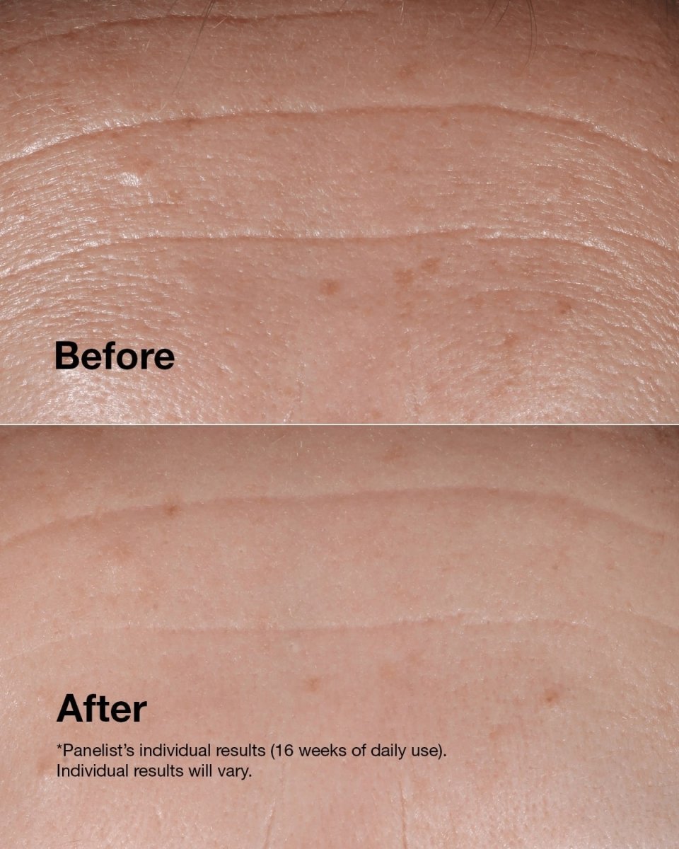 Clinique Smart Clinical Repair™ Wrinkle Correcting Serum - RUTHERFORD & Co