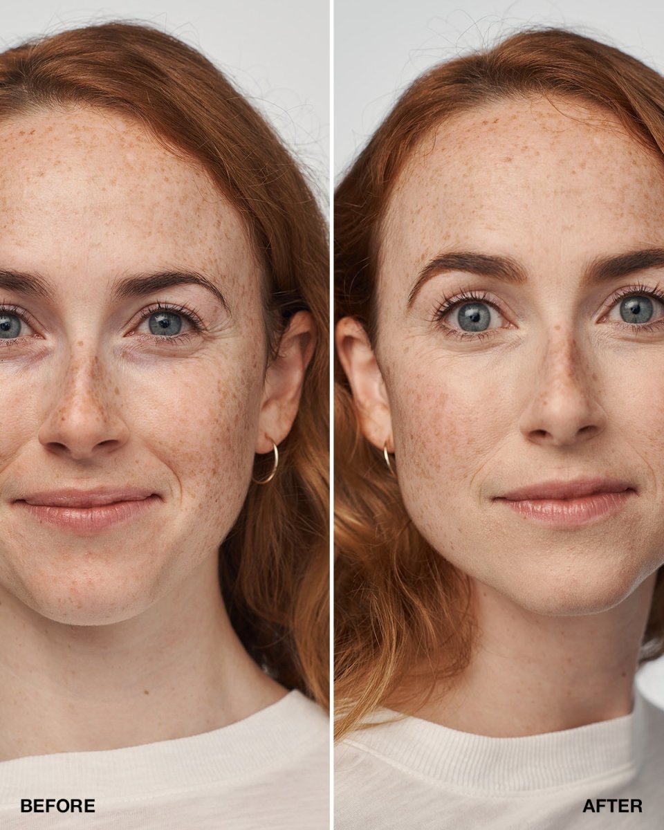 Even Better Clinical™ Serum Foundation SPF20 - RUTHERFORD & Co