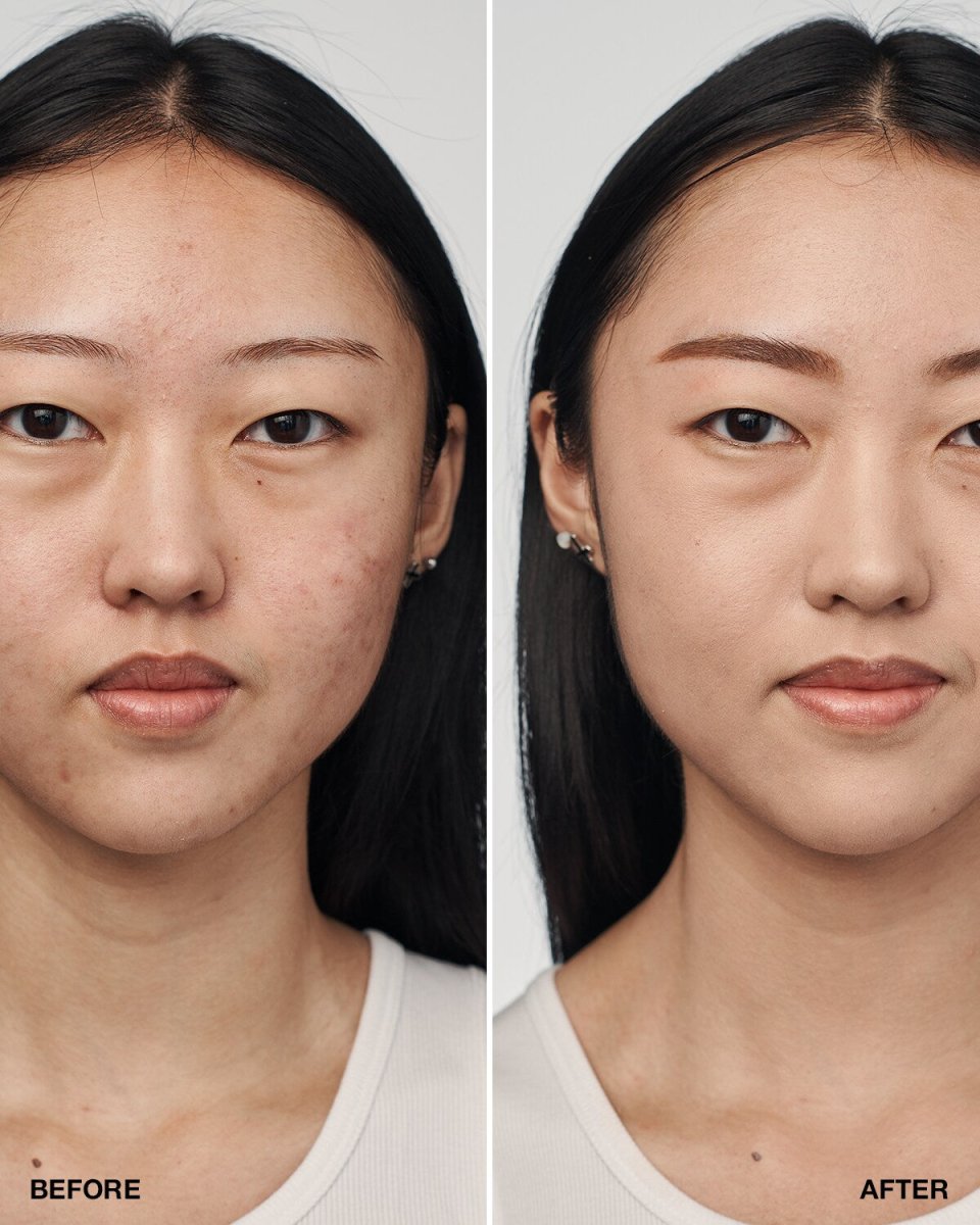 Even Better Clinical™ Serum Foundation SPF20 - RUTHERFORD & Co