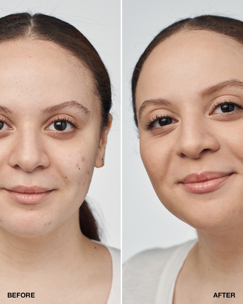 Even Better Clinical™ Serum Foundation SPF20 - RUTHERFORD & Co
