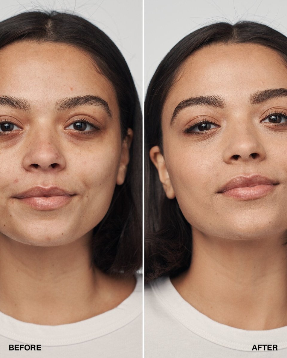 Even Better Clinical™ Serum Foundation SPF20 - RUTHERFORD & Co