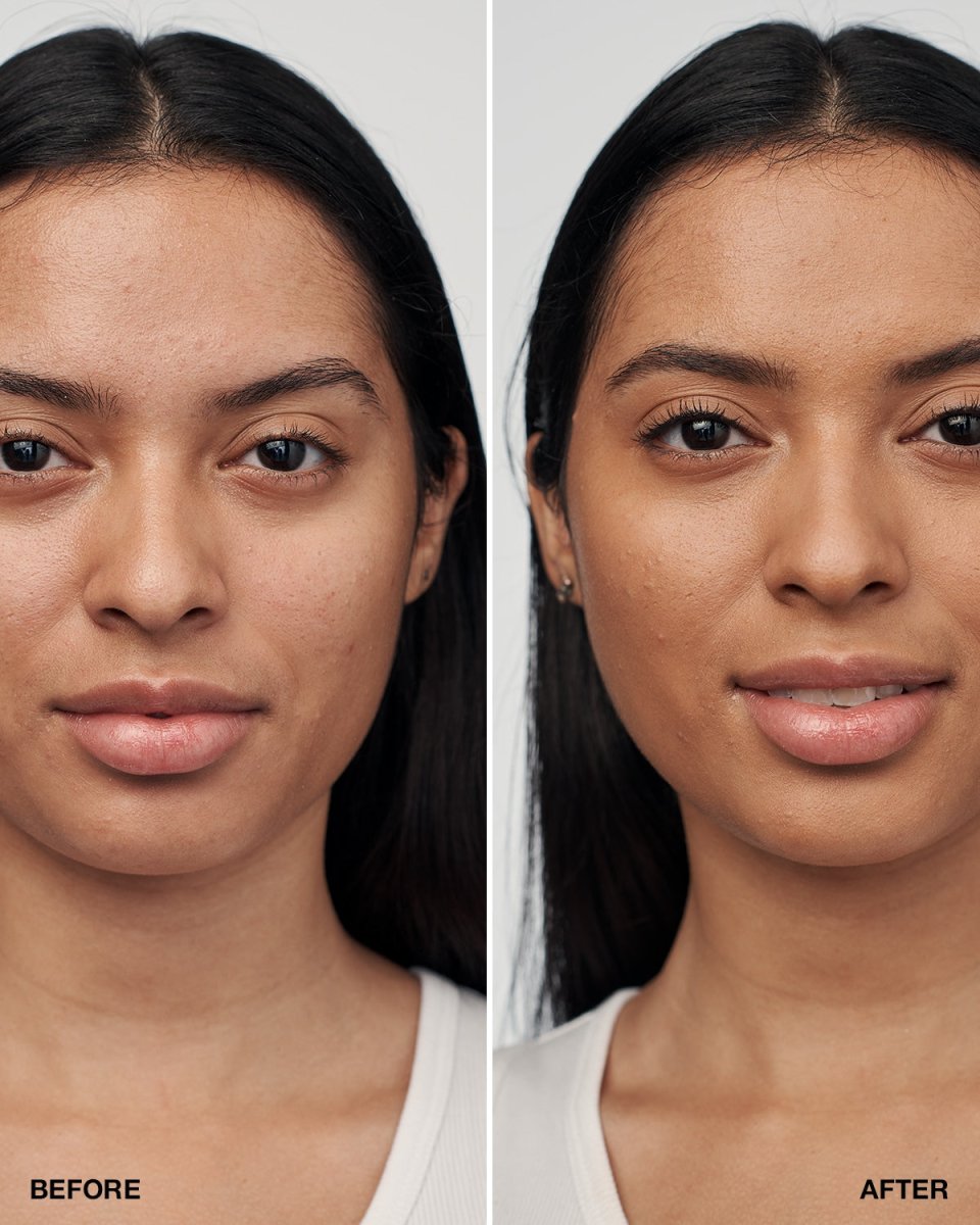 Even Better Clinical™ Serum Foundation SPF20 - RUTHERFORD & Co