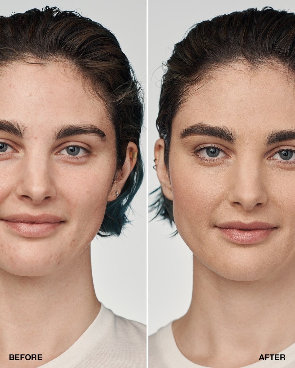 Even Better Clinical™ Serum Foundation SPF20 - RUTHERFORD & Co