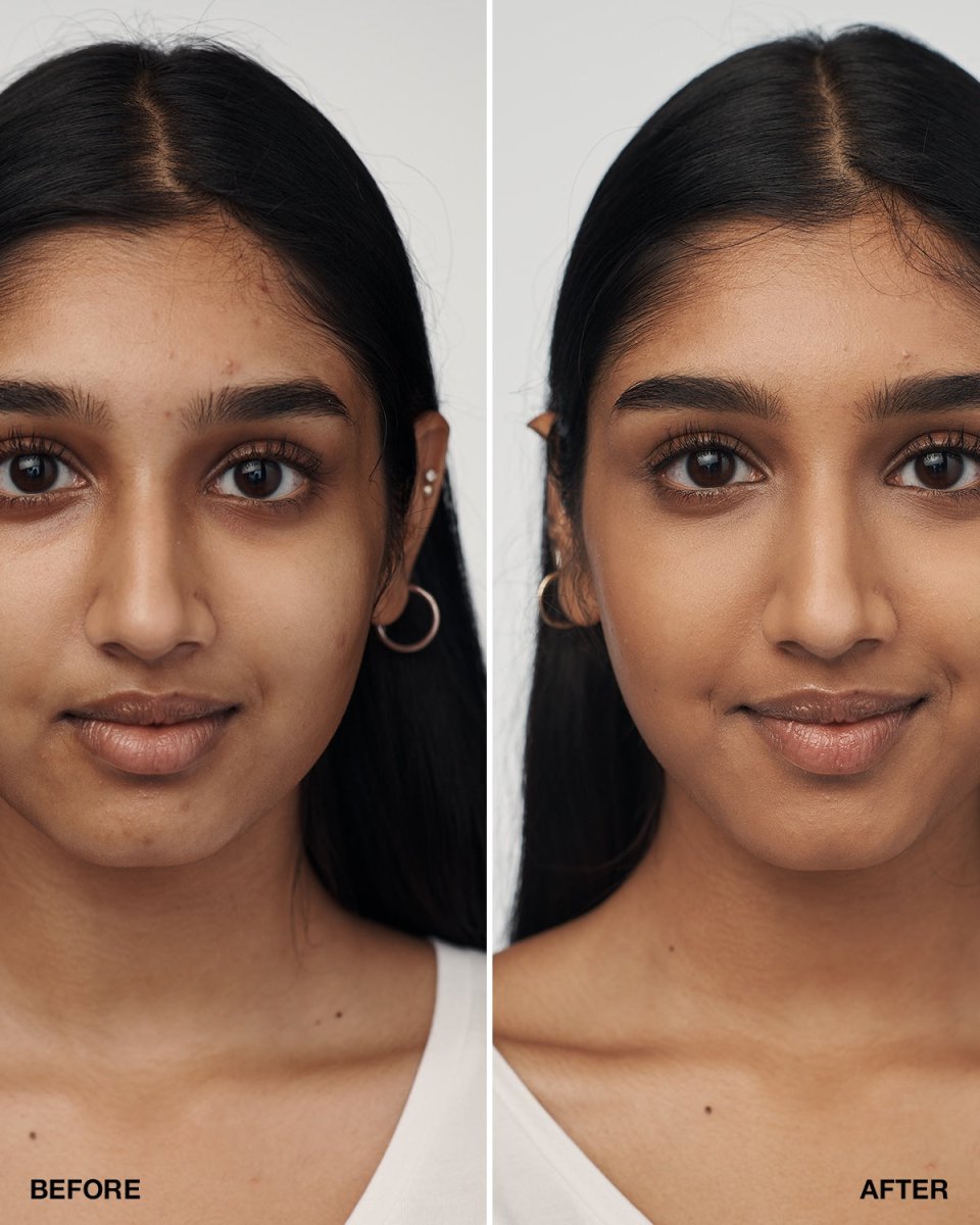 Even Better Clinical™ Serum Foundation SPF20 - RUTHERFORD & Co