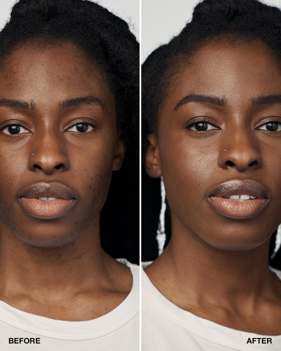 Even Better Clinical™ Serum Foundation SPF20 - RUTHERFORD & Co