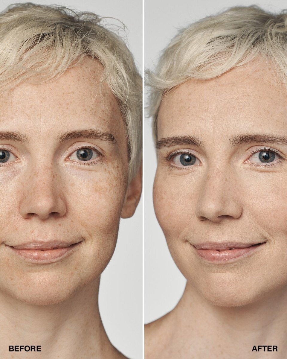 Even Better Clinical™ Serum Foundation SPF20 - RUTHERFORD & Co