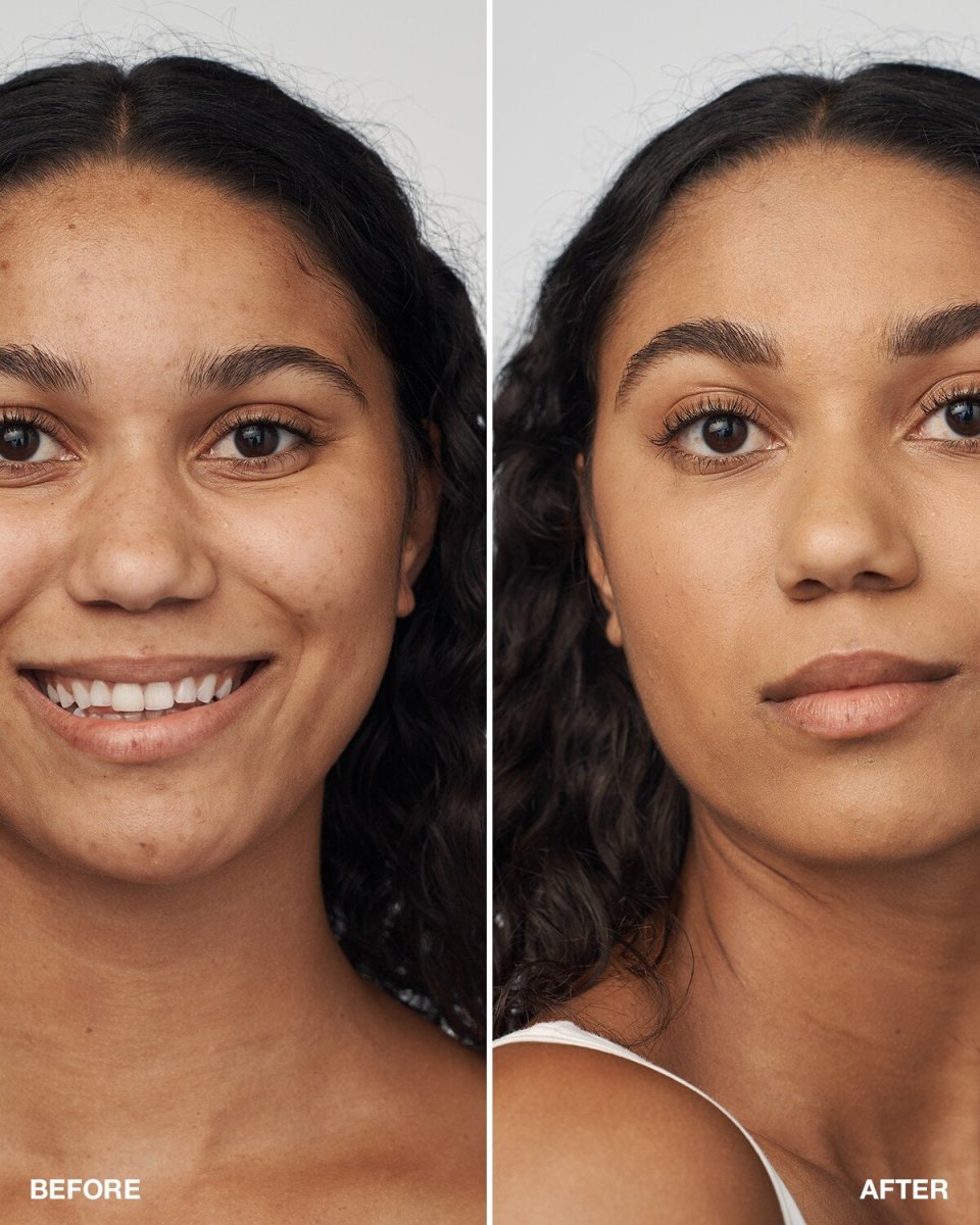 Even Better Clinical™ Serum Foundation SPF20 - RUTHERFORD & Co