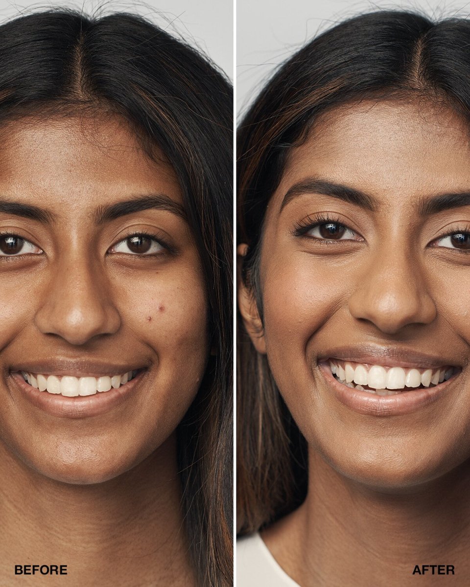 Even Better Clinical™ Serum Foundation SPF20 - RUTHERFORD & Co