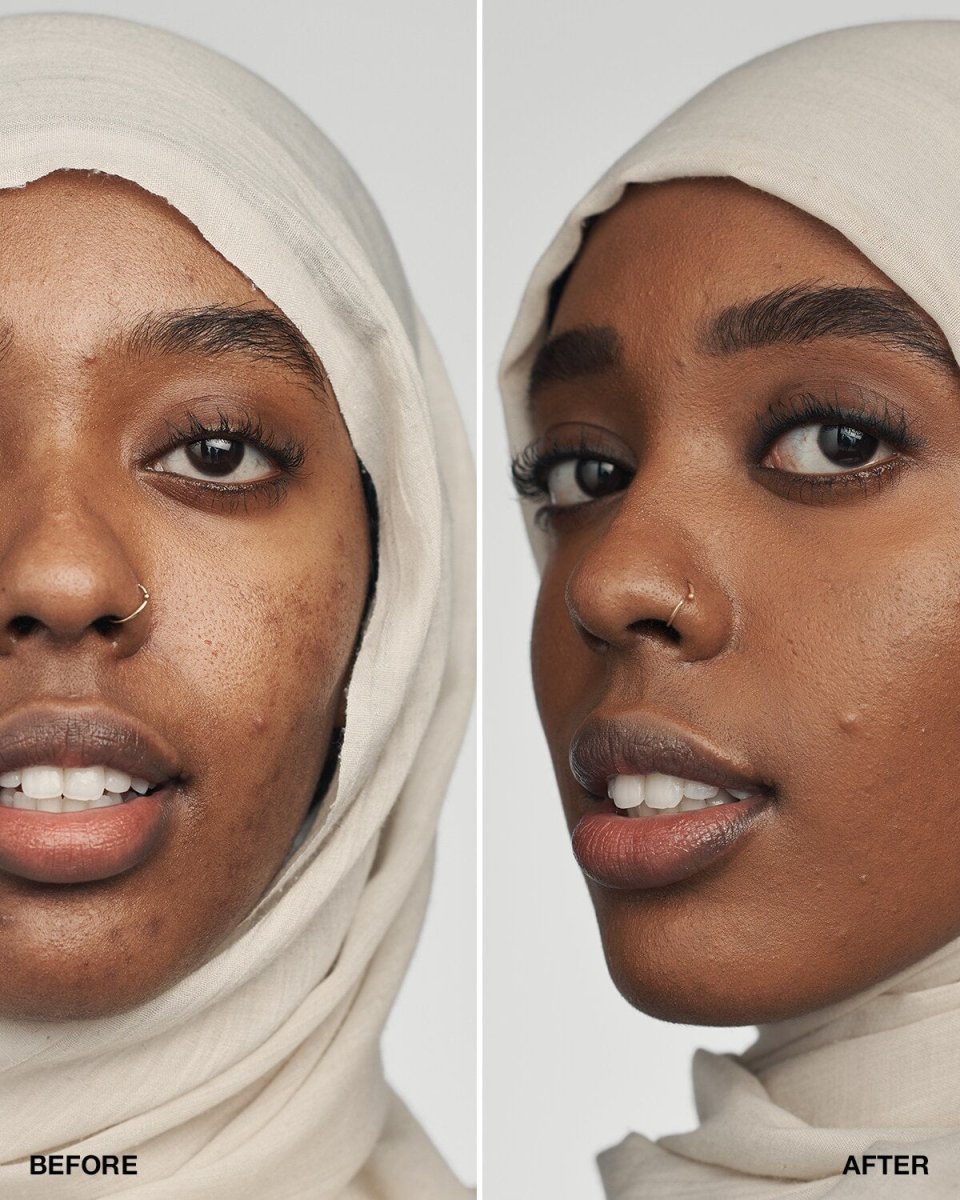 Even Better Clinical™ Serum Foundation SPF20 - RUTHERFORD & Co