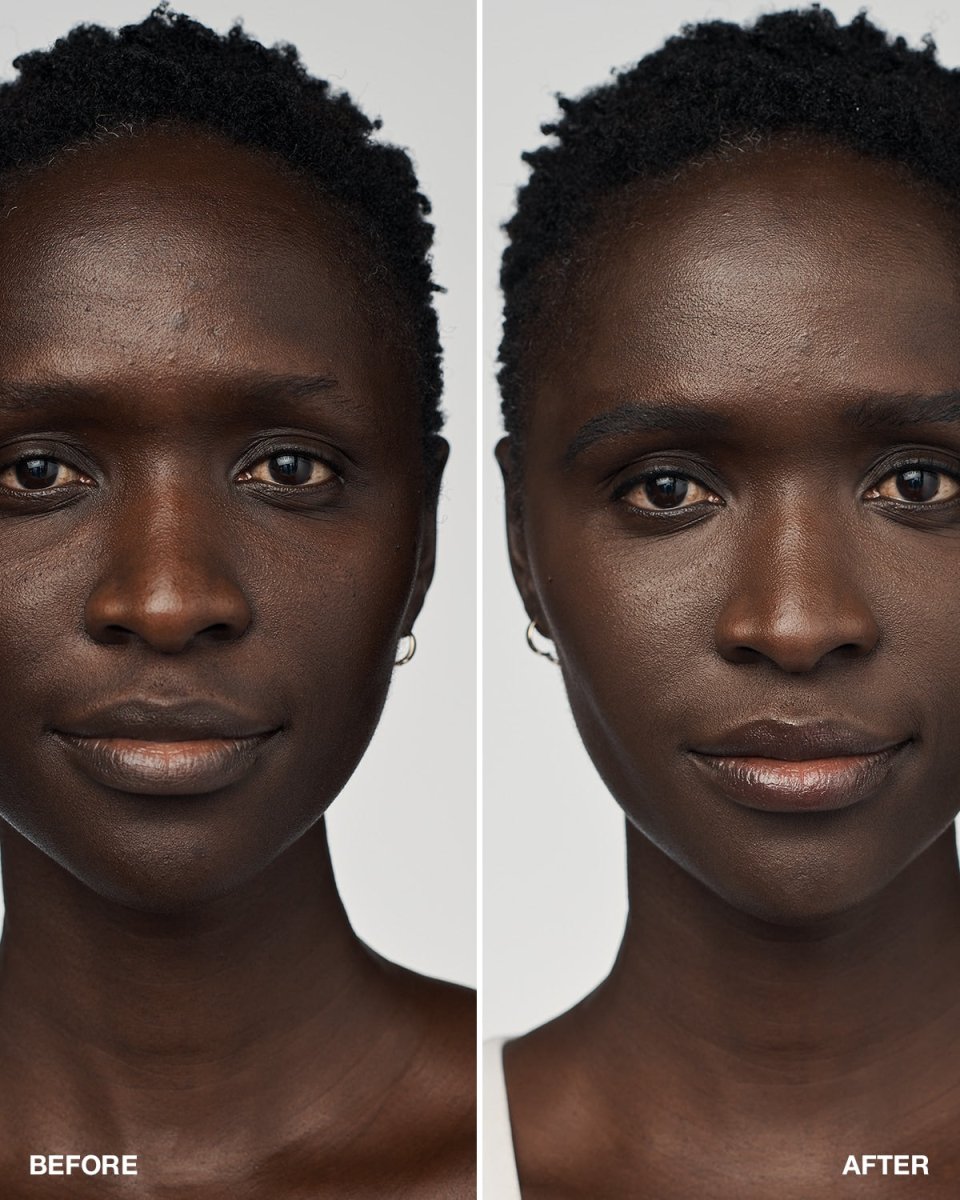 Even Better Clinical™ Serum Foundation SPF20 - RUTHERFORD & Co