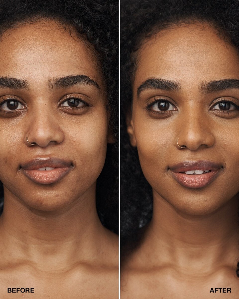 Even Better Clinical™ Serum Foundation SPF20 - RUTHERFORD & Co