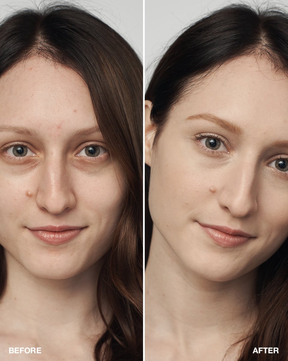 Even Better Clinical™ Serum Foundation SPF20 - RUTHERFORD & Co