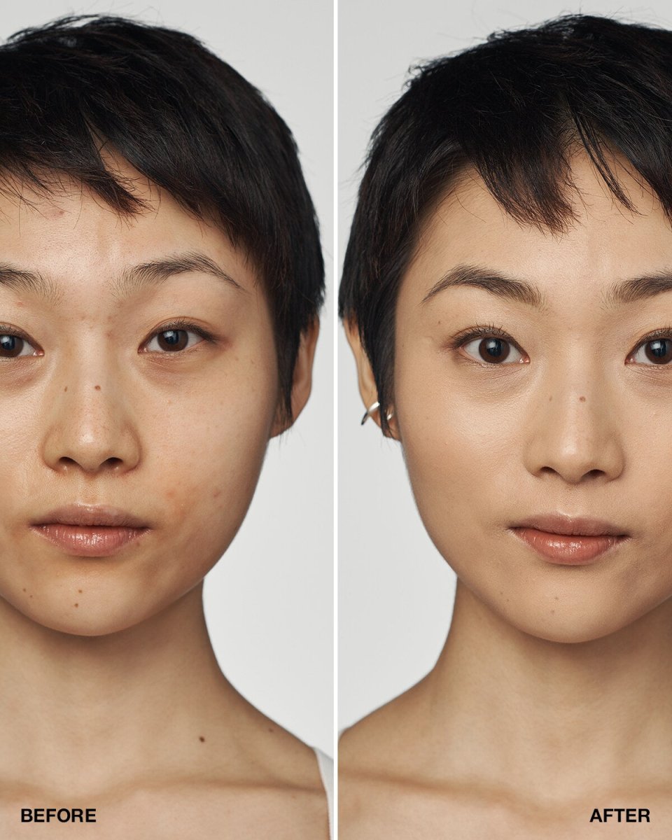 Even Better Clinical™ Serum Foundation SPF20 - RUTHERFORD & Co