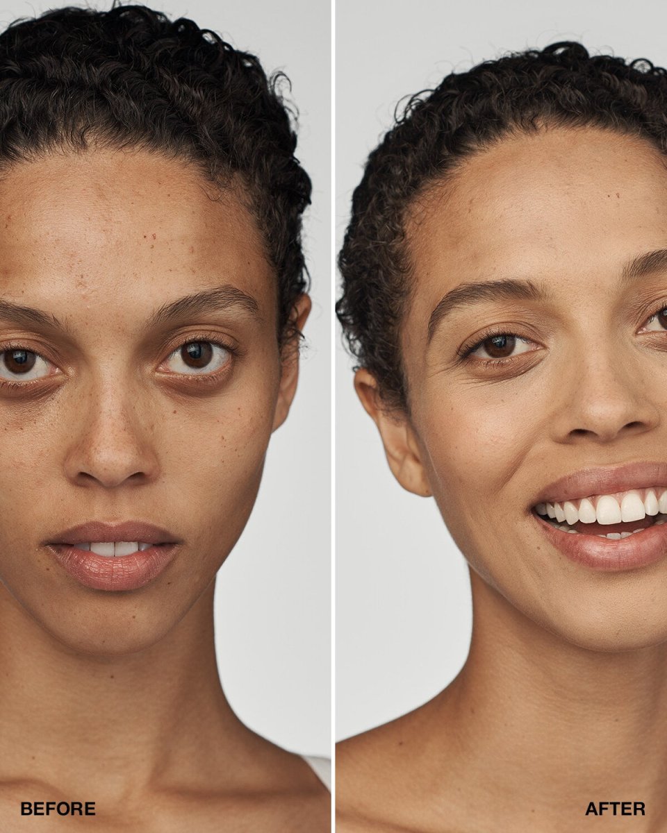 Even Better Clinical™ Serum Foundation SPF20 - RUTHERFORD & Co