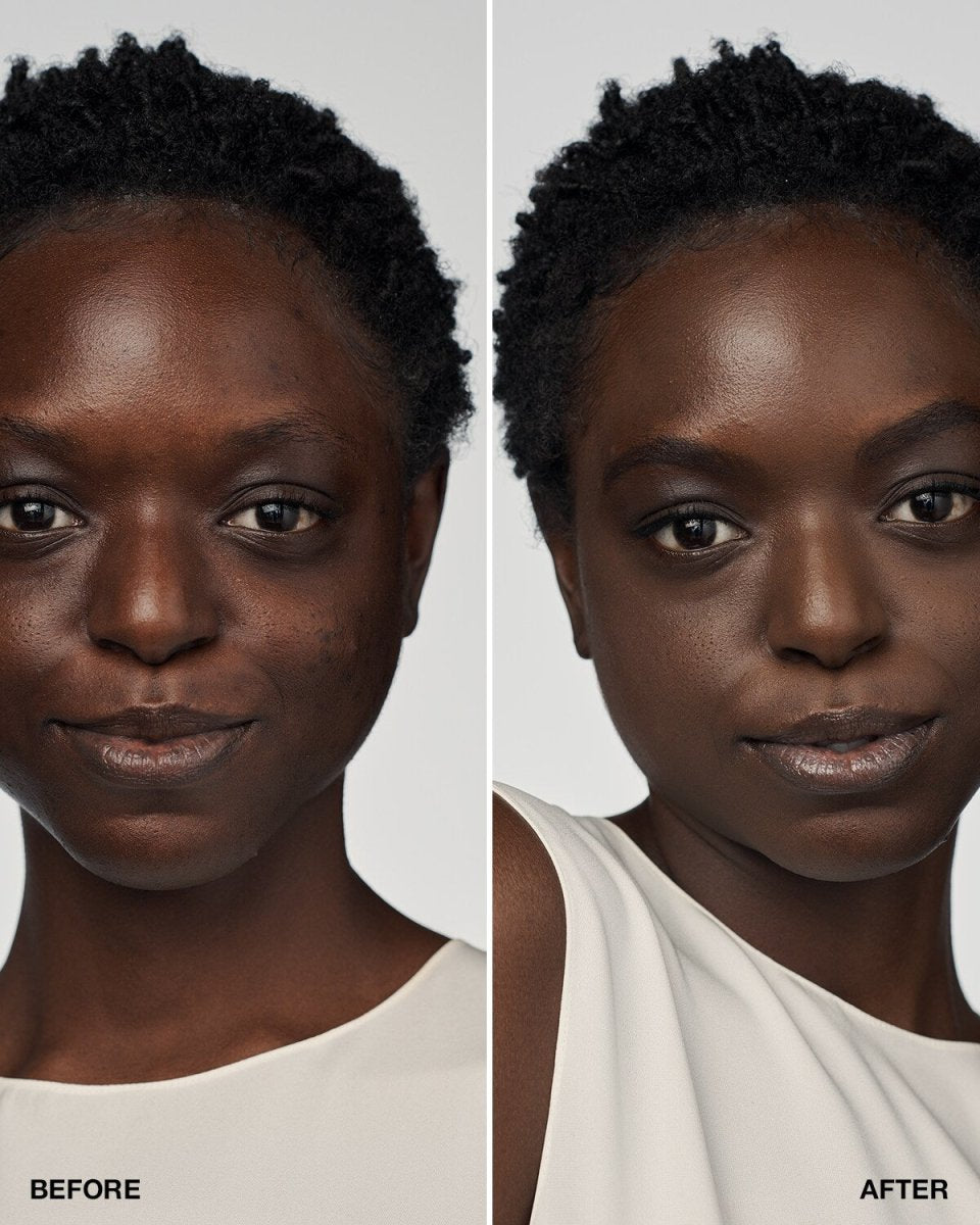 Even Better Clinical™ Serum Foundation SPF20 - RUTHERFORD & Co