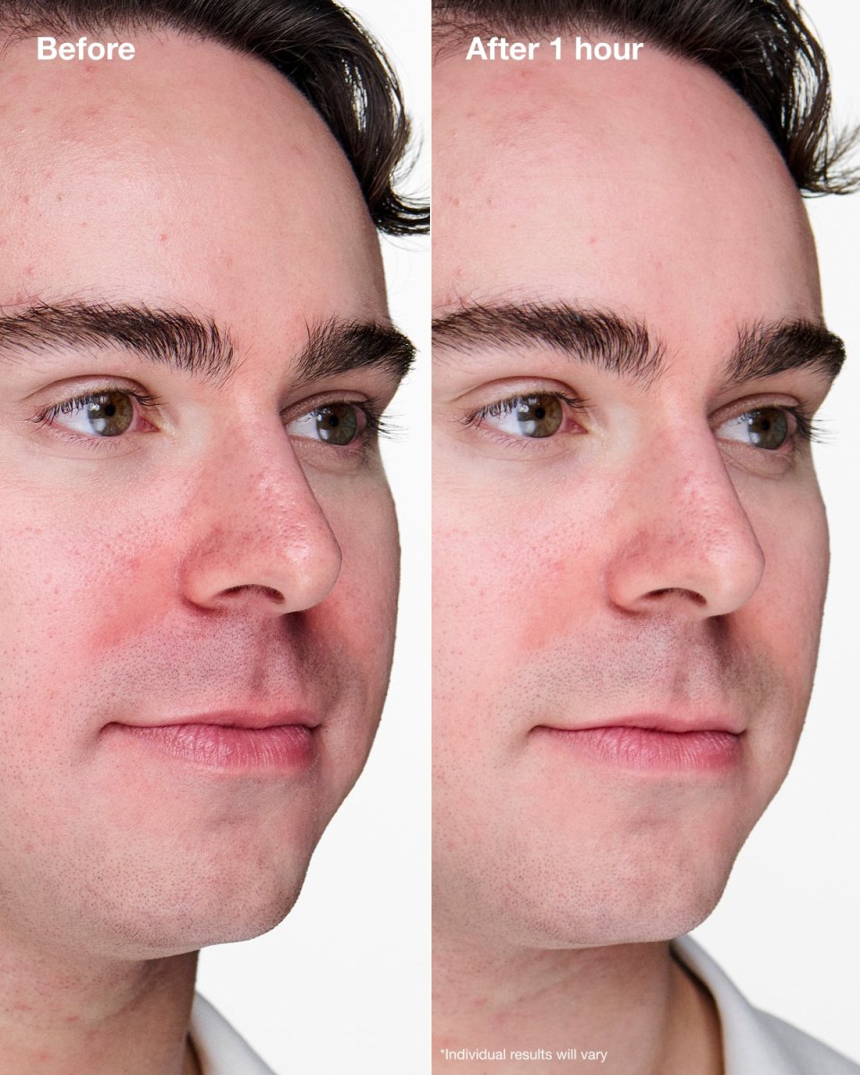 NEW Anti - Blemish Solutions Clinical™ Advanced Clearing Gel - RUTHERFORD & Co