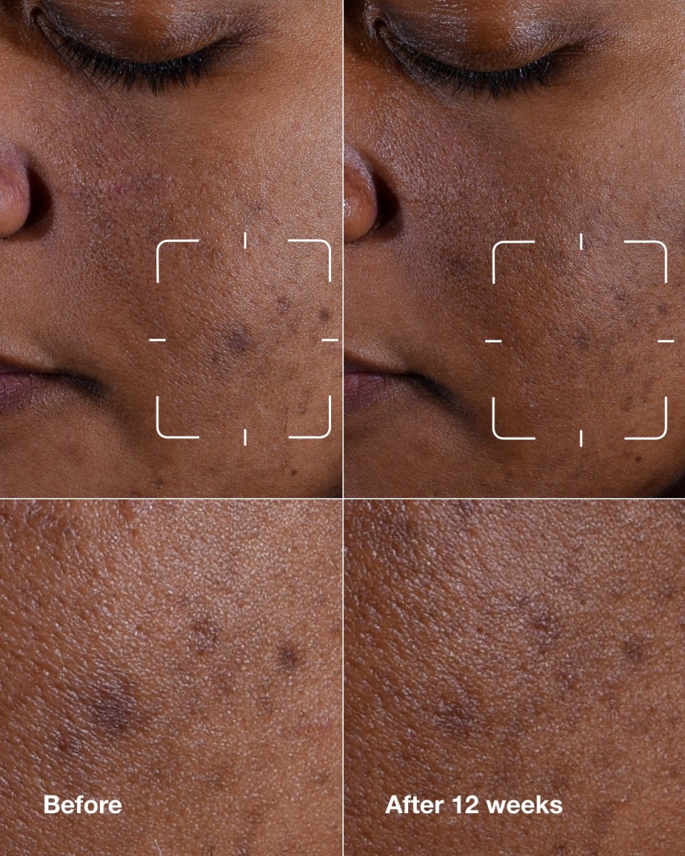 NEW Even Better Clinical™ Dark Spot Clearing Serum - RUTHERFORD & Co