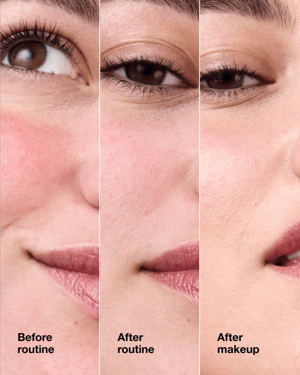 Redness Solutions Makeup SPF 15 - RUTHERFORD & Co