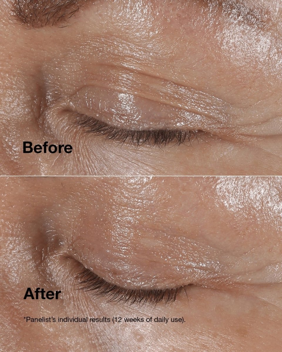 Smart Clinical Repair™ Wrinkle Correcting Eye Cream - RUTHERFORD & Co